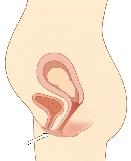 Die Vulva in der Schwangerschaft